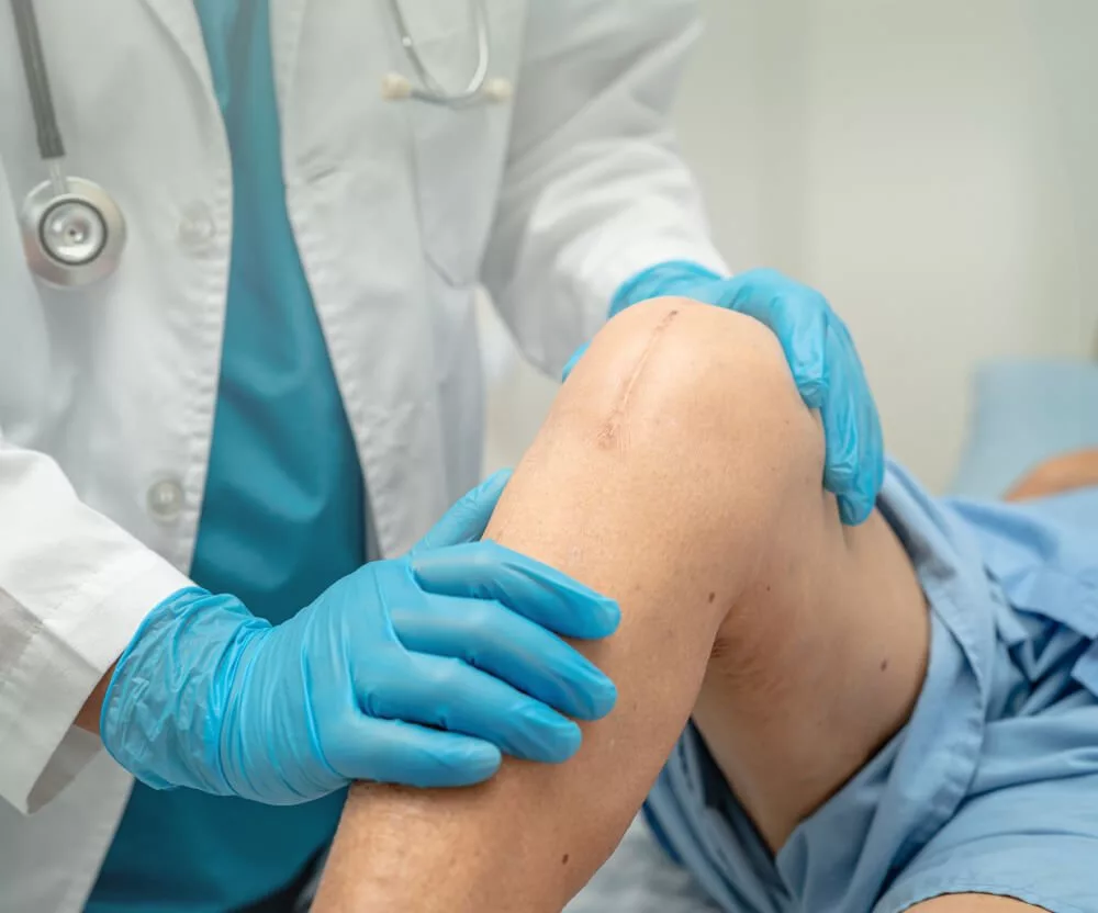 Knee Replacement